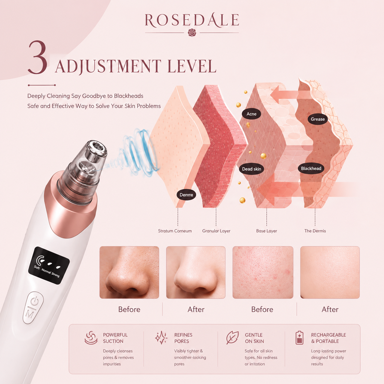 Rosedale ClearPore™ - Smart Derma Suction