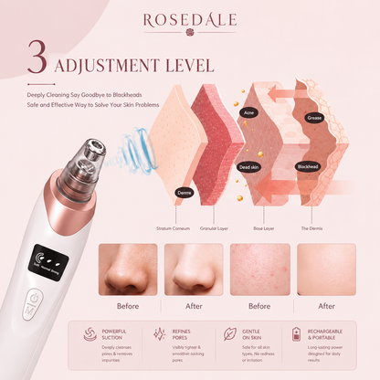 Rosedale ClearPore™ - Smart Derma Suction