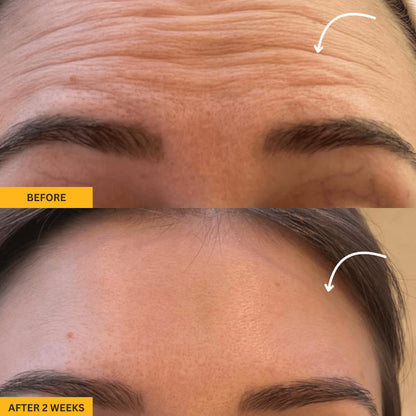 Rose Lift for Depuffed & Glowing Skin