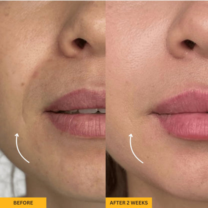 Rose Lift for Depuffed & Glowing Skin