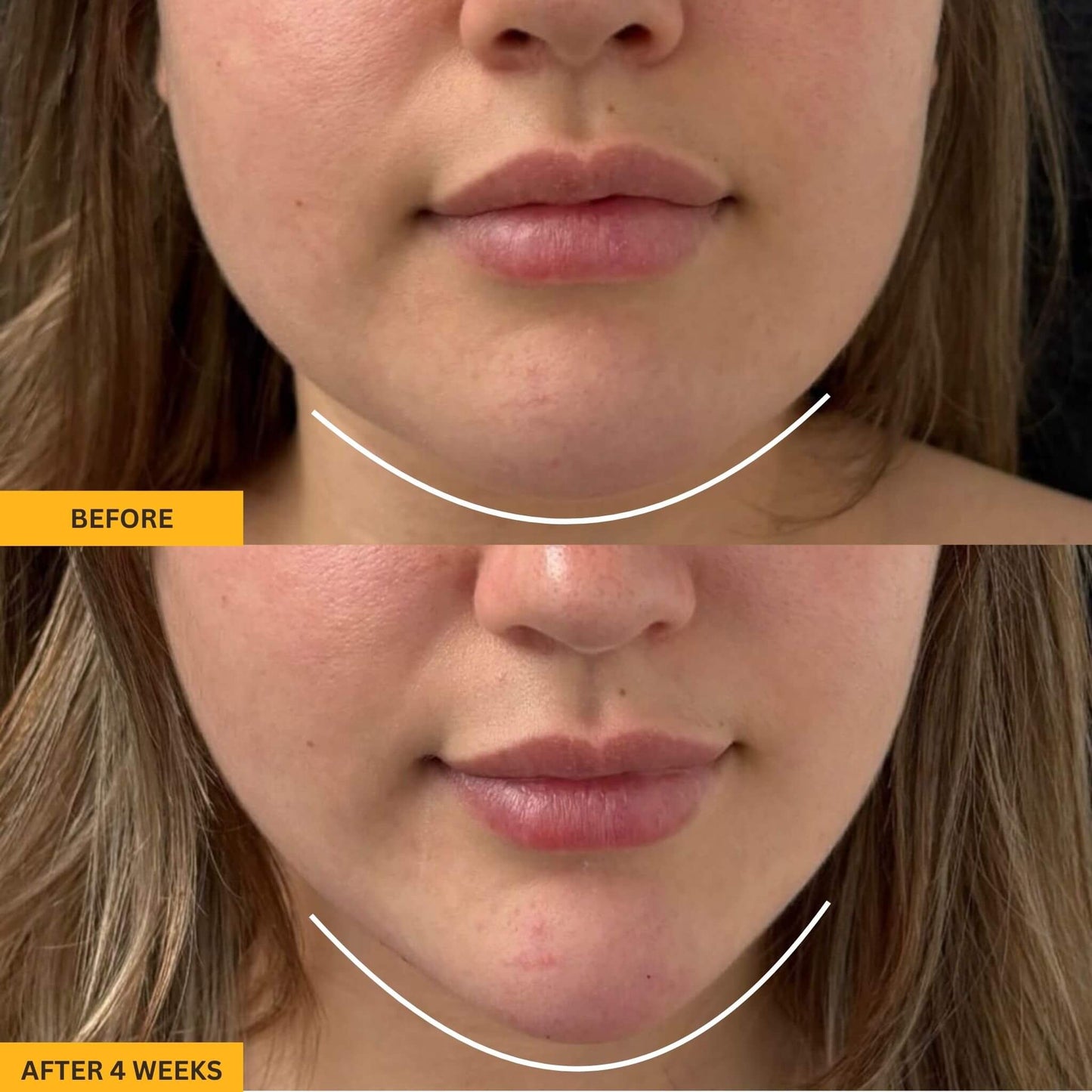 Rose Lift for Depuffed & Glowing Skin