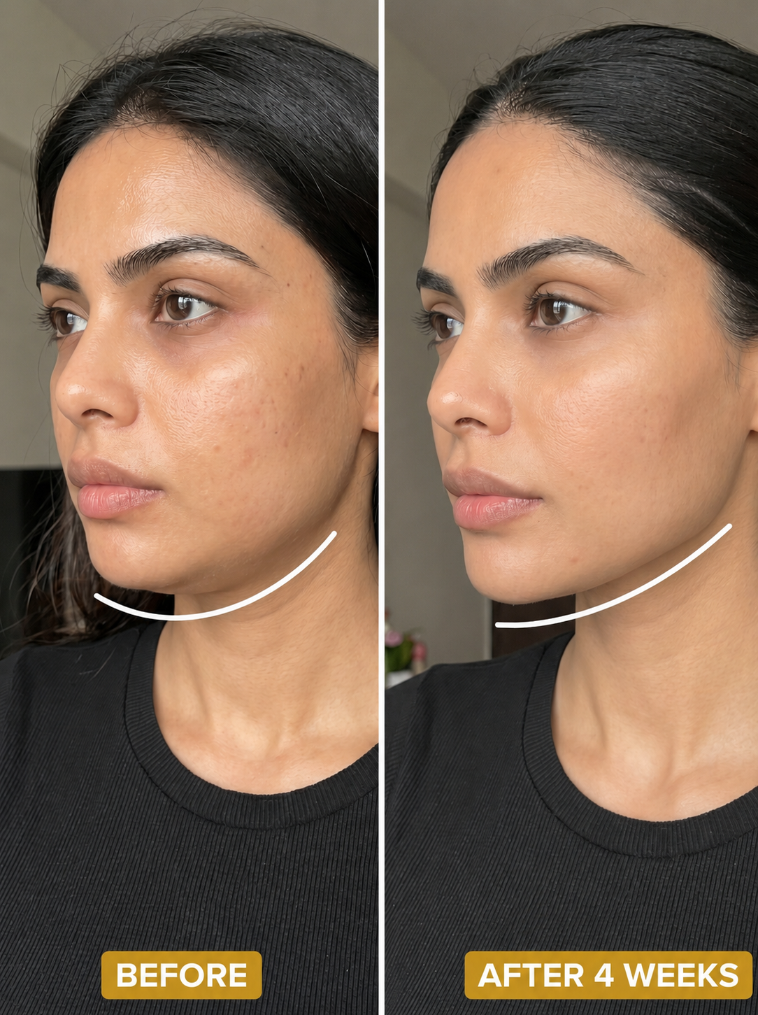 Rose Lift for Depuffed & Glowing Skin